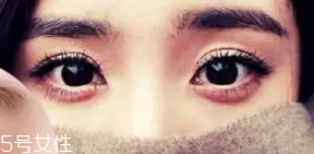 臥蠶和眼袋的區(qū)別是什么？臥蠶是肌肉眼袋是肥肉