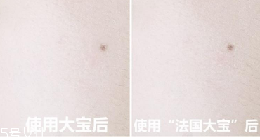 范爺同款法國(guó)大寶Embryolisse和大寶SOD蜜哪個(gè)好用？