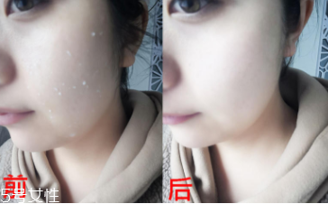 rosette去角質(zhì)凝膠怎么樣？真正的去角質(zhì)產(chǎn)品