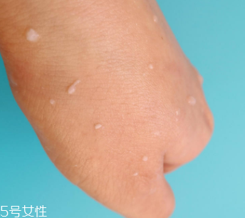 rosette去角質(zhì)凝膠怎么樣？真正的去角質(zhì)產(chǎn)品