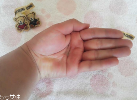 柳屋生發(fā)水有用嗎？一個(gè)月后長(zhǎng)出新發(fā)
