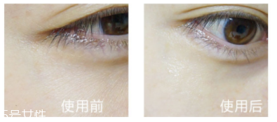 shangpree香蒲麗眼膜適合多大年齡？任何年齡