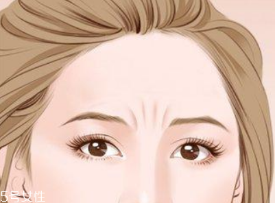 川字紋可以手術(shù)去除嗎？選擇手術(shù)需謹慎