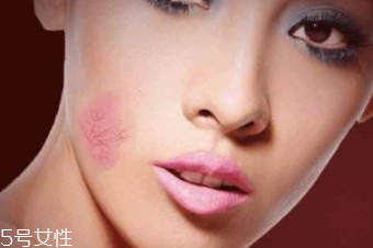 紅血絲用哪種護(hù)膚品？6款大牌全面對(duì)抗紅血絲