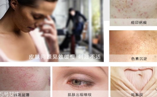 德國(guó)krauterhof蝸牛精華膏效果怎么樣？