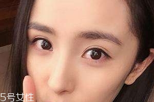 葉黃素能治療夜盲癥嗎？看什么類型的