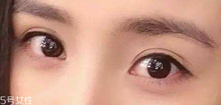 葉黃素能治療夜盲癥嗎？看什么類型的