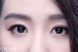 葉黃素會(huì)過(guò)敏嗎？一般不會(huì)的