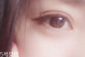 葉黃素一天吃多少毫克？按說(shuō)明服用
