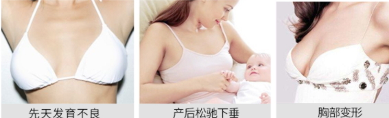 豐胸霜怎么用？豐胸霜使用手法詳解