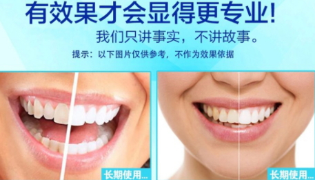 美白牙貼會反彈嗎？牙貼美白效果持續(xù)多久