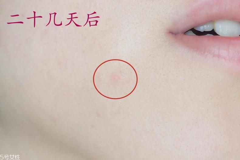 雅詩(shī)蘭黛晶透沁白防曬搖搖乳成膜快嗎？適合油痘皮嗎？