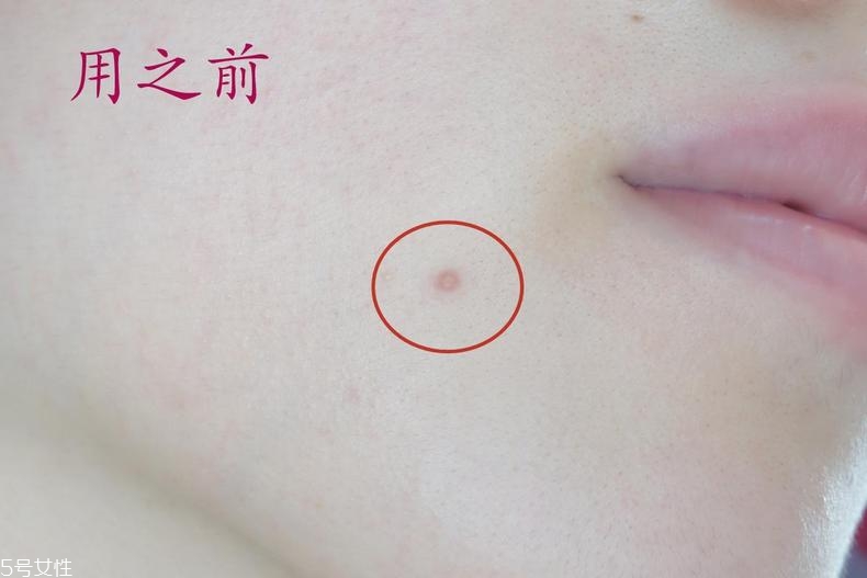 雅詩(shī)蘭黛晶透沁白防曬搖搖乳成膜快嗎？適合油痘皮嗎？