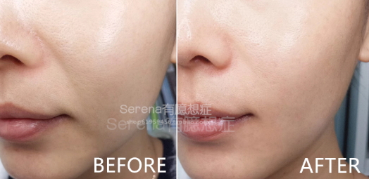 dermawand逆齡射頻注氧棒怎么用？
