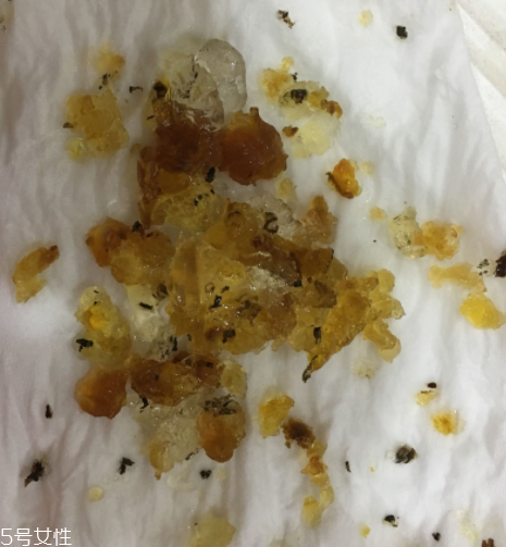 桃膠能和雞蛋一起吃嗎？桃膠配雞蛋可以嗎？