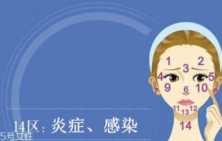 臉上各部位長痘痘圖解 快速祛痘的簡(jiǎn)單方法
