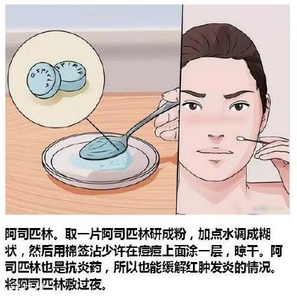 臉上各部位長痘痘圖解 快速祛痘的簡(jiǎn)單方法
