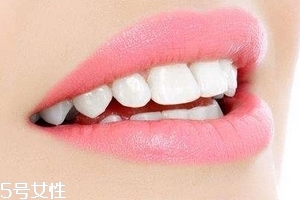 超聲波潔牙牙齒會(huì)變白嗎？超聲波潔牙心得