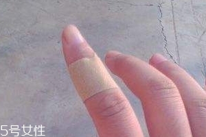 創(chuàng)可貼可以消腫嗎？創(chuàng)可貼有消腫功效嗎？