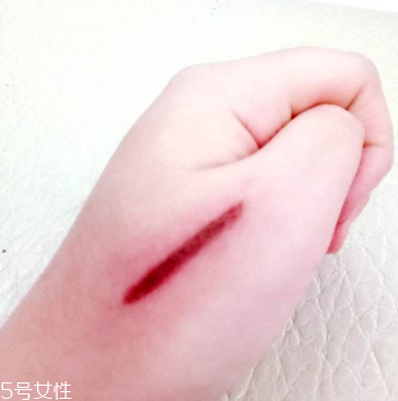 創(chuàng)可貼和肉連著怎么辦？創(chuàng)可貼連著肉怎么處理？
