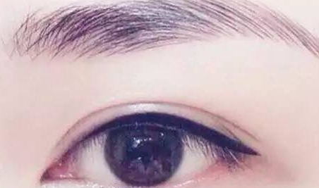 提眉和雙眼皮一起做嗎？提眉和雙眼皮要隔開(kāi)多久