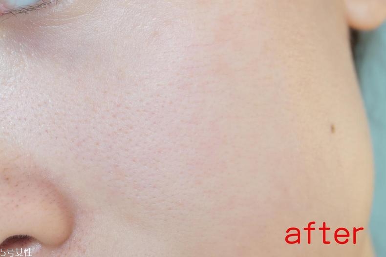 radha beauty vc精華白天能用嗎？敏感肌能用嗎？