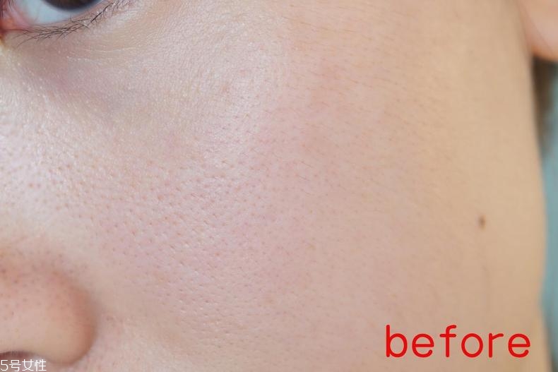 radha beauty vc精華白天能用嗎？敏感肌能用嗎？