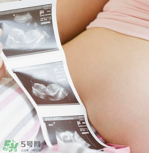 頭胎雙胞胎還能生二胎嗎？雙胞胎家庭能要二胎嗎？