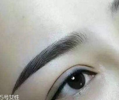 紋眉是不是很疼 也沒(méi)那么疼