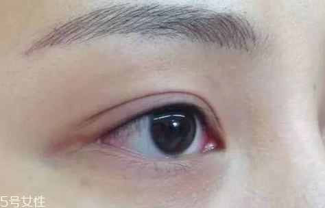 美瞳線(xiàn)要補(bǔ)色嗎 這個(gè)是需要的