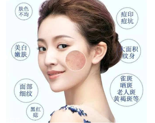 皮秒會(huì)反黑嗎 這是正?，F(xiàn)象