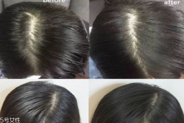 碧緹絲免洗噴霧有害嗎 只能用來(lái)急救解決小尷尬