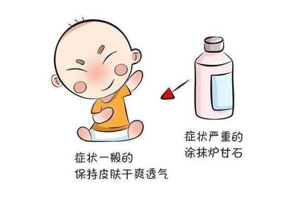 過(guò)敏能吃牛肉嗎 過(guò)敏能吃雞蛋牛奶嗎
