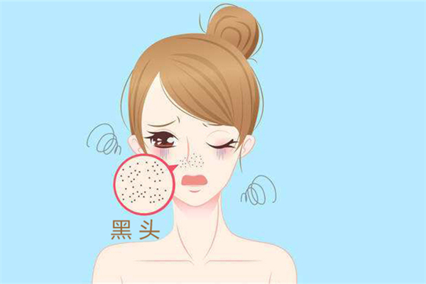 黑頭是怎么產生的 黑頭可以擠嗎