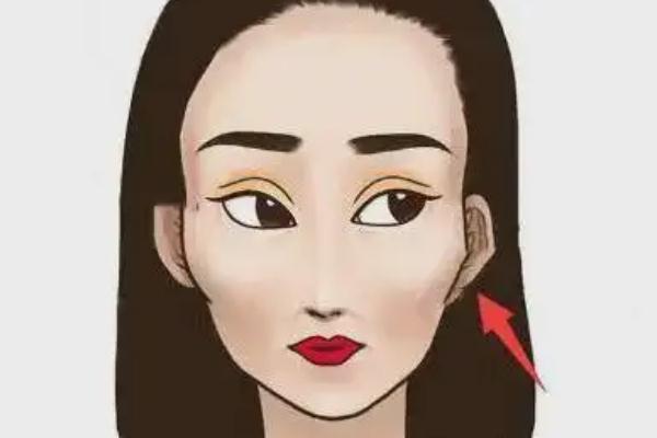 顴骨內推和磨骨哪個風險大 顴骨內推的危害