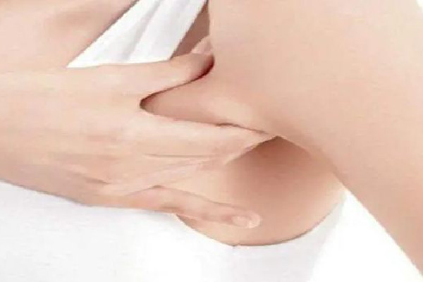 副乳切除手術(shù)是全麻還是局麻 副乳切除手術(shù)后多久可以正?；顒?dòng)