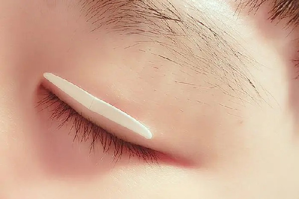 雙眼皮貼直接撕會(huì)怎樣 雙眼皮貼怎么取下來