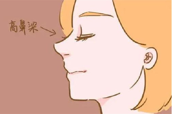 武漢假體隆鼻哪家好 武漢假體隆鼻多少錢(qián)