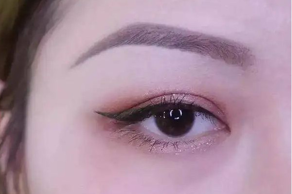 武漢激光洗眉毛的醫(yī)院推薦 武漢激光洗眉毛一般要多少錢(qián)