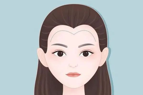 武漢做發(fā)際線一般多少錢(qián)啊 武漢做發(fā)際線的醫(yī)院