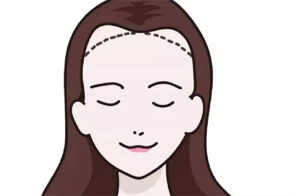 武漢做發(fā)際線一般多少錢(qián)啊 武漢做發(fā)際線的醫(yī)院